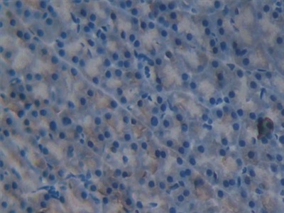 Polyclonal Antibody to Interleukin 1 Delta (FIL1d)