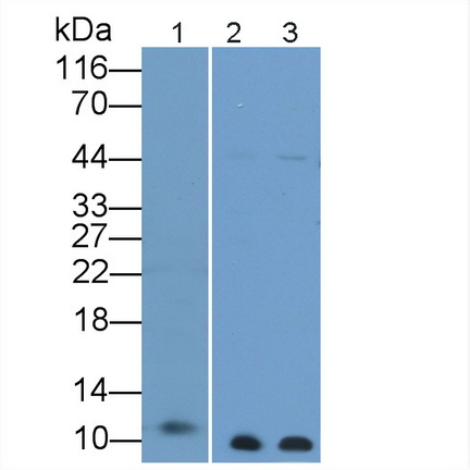 Polyclonal Antibody to S100 Calcium Binding Protein B (S100B)