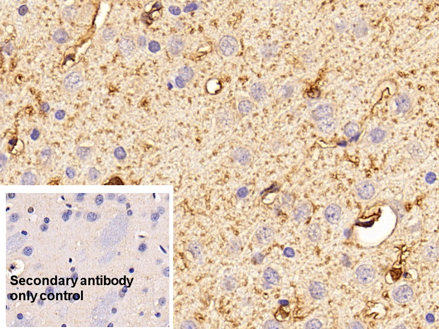 Polyclonal Antibody to S100 Calcium Binding Protein B (S100B)