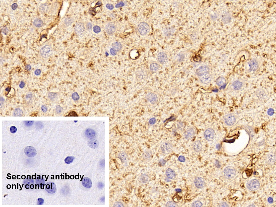 Polyclonal Antibody to S100 Calcium Binding Protein B (S100B)