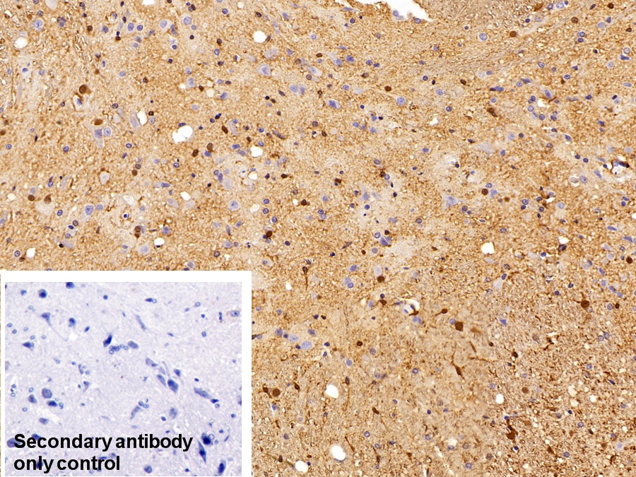 Polyclonal Antibody to S100 Calcium Binding Protein B (S100B)