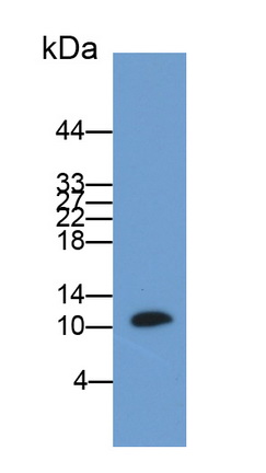 Polyclonal Antibody to S100 Calcium Binding Protein B (S100B)