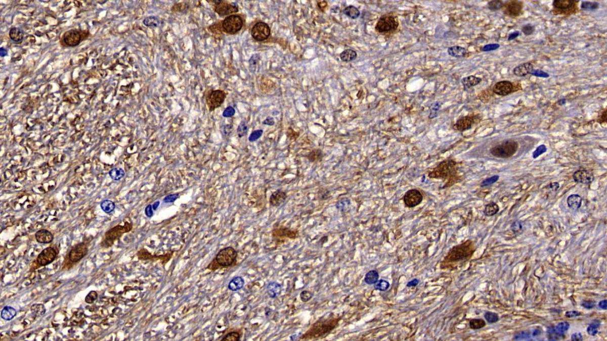 Polyclonal Antibody to S100 Calcium Binding Protein B (S100B)