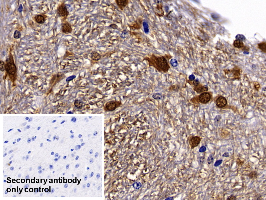 Polyclonal Antibody to S100 Calcium Binding Protein B (S100B)