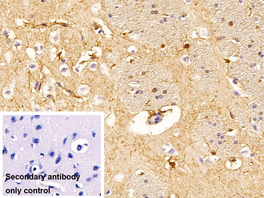 Polyclonal Antibody to S100 Calcium Binding Protein B (S100B)