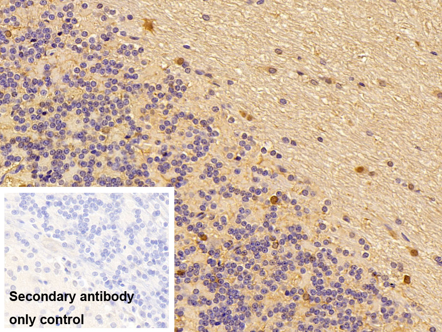 Polyclonal Antibody to S100 Calcium Binding Protein B (S100B)