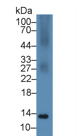 Polyclonal Antibody to S100 Calcium Binding Protein A11 (S100A11)