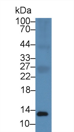 Polyclonal Antibody to S100 Calcium Binding Protein A11 (S100A11)