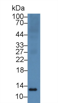 Polyclonal Antibody to S100 Calcium Binding Protein A11 (S100A11)