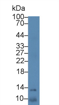 Polyclonal Antibody to S100 Calcium Binding Protein A11 (S100A11)