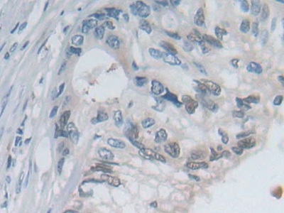 Polyclonal Antibody to P-Selectin (SELP)