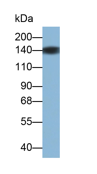 Polyclonal Antibody to P-Selectin (SELP)