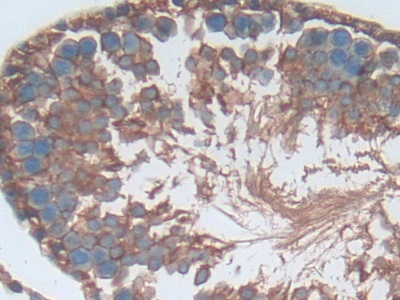 Polyclonal Antibody to P-Selectin (SELP)