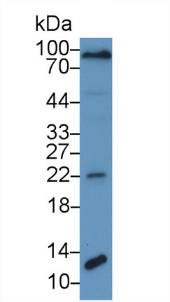 Polyclonal Antibody to Procollagen III N-Terminal Propeptide (PIIINP)