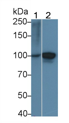 Polyclonal Antibody to Procollagen III N-Terminal Propeptide (PIIINP)