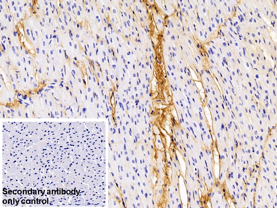 Polyclonal Antibody to Procollagen III N-Terminal Propeptide (PIIINP)