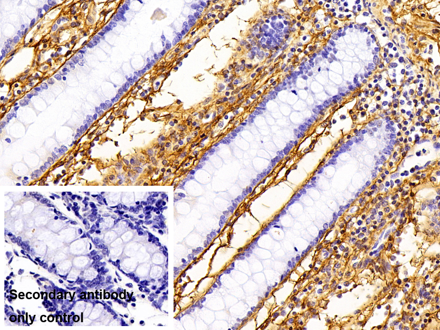 Polyclonal Antibody to Procollagen III N-Terminal Propeptide (PIIINP)