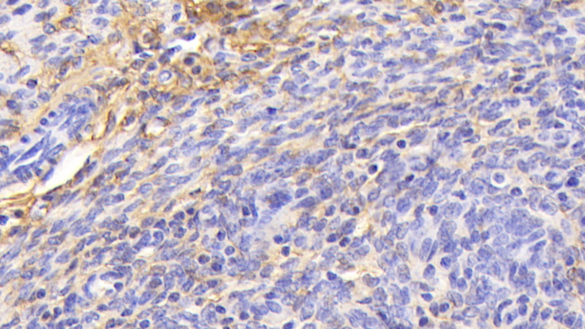 Polyclonal Antibody to Procollagen III N-Terminal Propeptide (PIIINP)