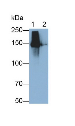 Polyclonal Antibody to Procollagen III N-Terminal Propeptide (PIIINP)