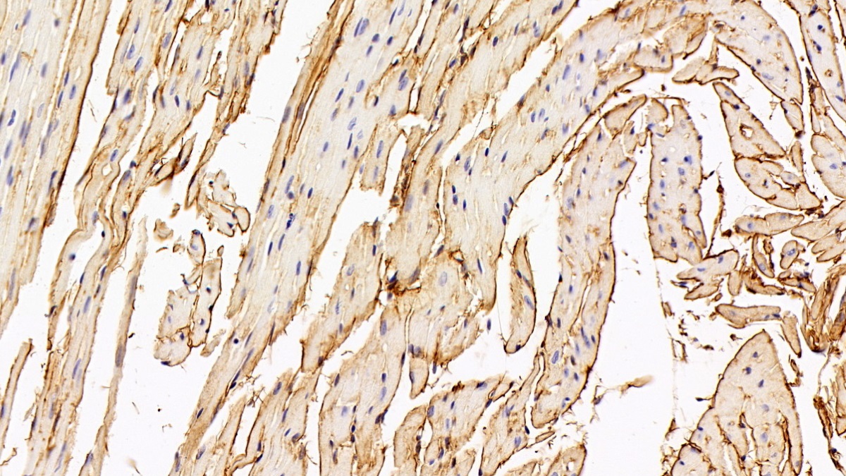 Polyclonal Antibody to Procollagen III N-Terminal Propeptide (PIIINP)