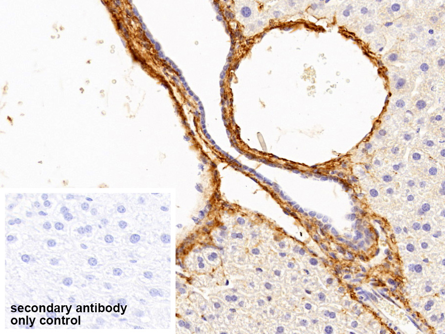 Polyclonal Antibody to Procollagen III N-Terminal Propeptide (PIIINP)