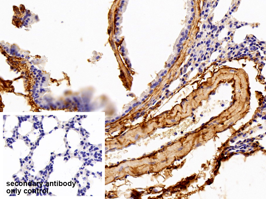 Polyclonal Antibody to Procollagen III N-Terminal Propeptide (PIIINP)