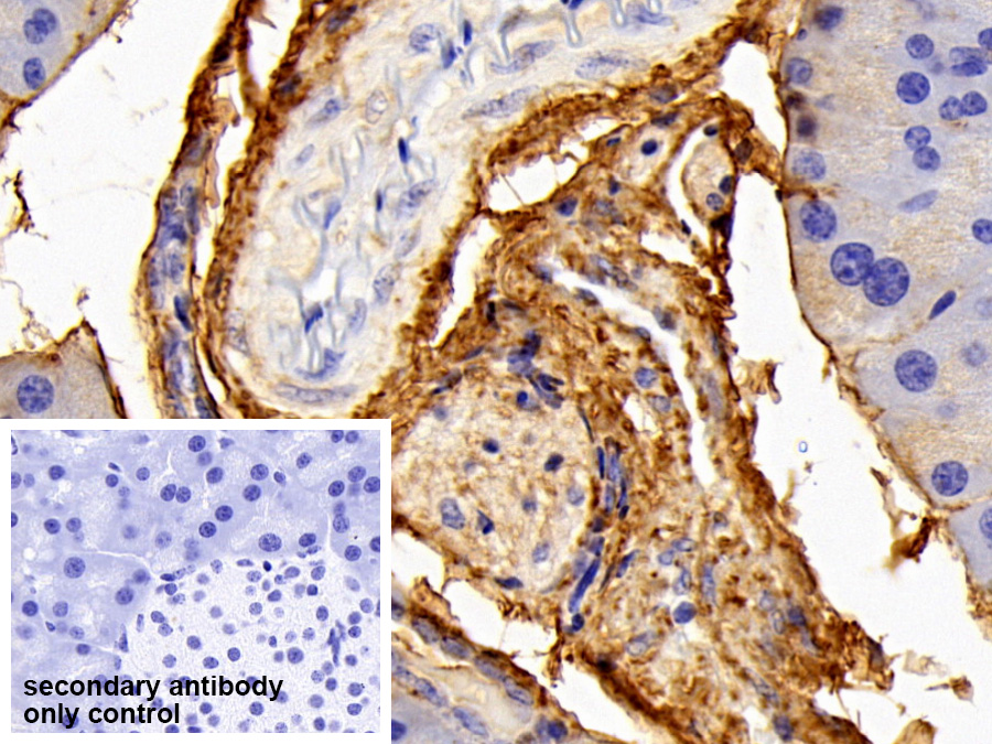 Polyclonal Antibody to Procollagen III N-Terminal Propeptide (PIIINP)