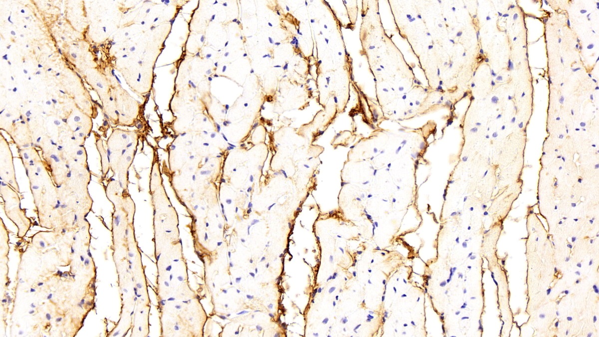 Polyclonal Antibody to Procollagen III N-Terminal Propeptide (PIIINP)