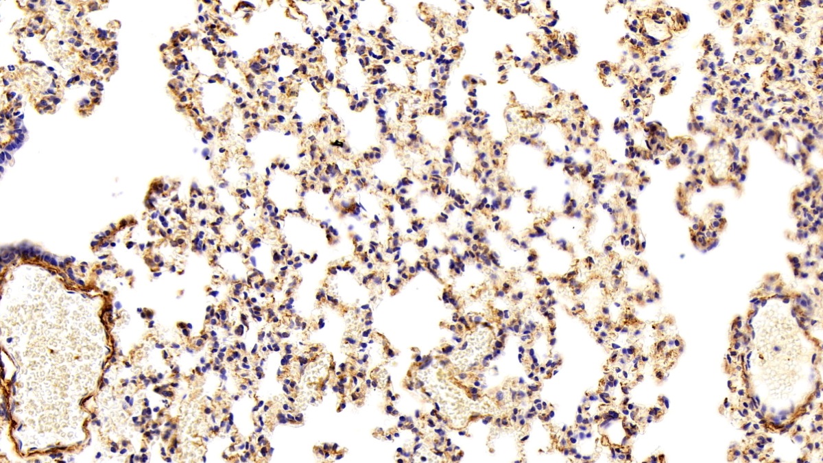 Polyclonal Antibody to Procollagen III N-Terminal Propeptide (PIIINP)