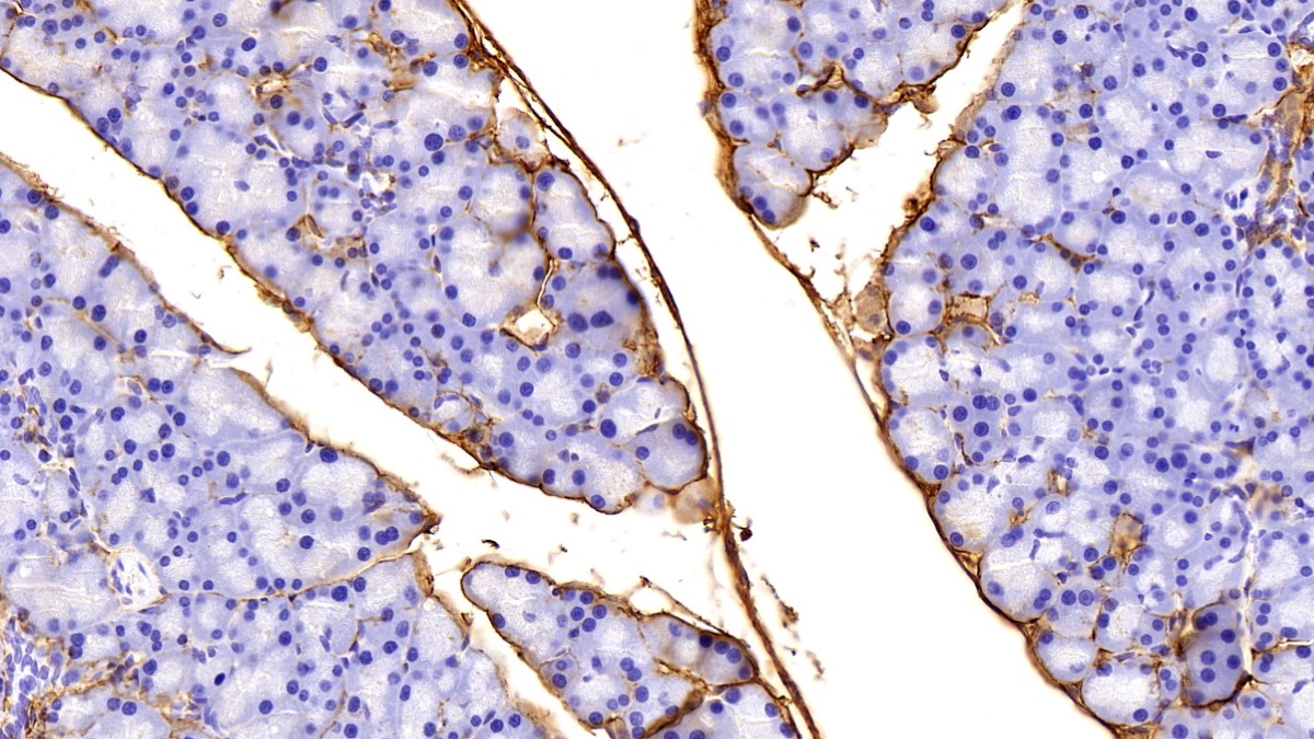 Polyclonal Antibody to Procollagen III N-Terminal Propeptide (PIIINP)