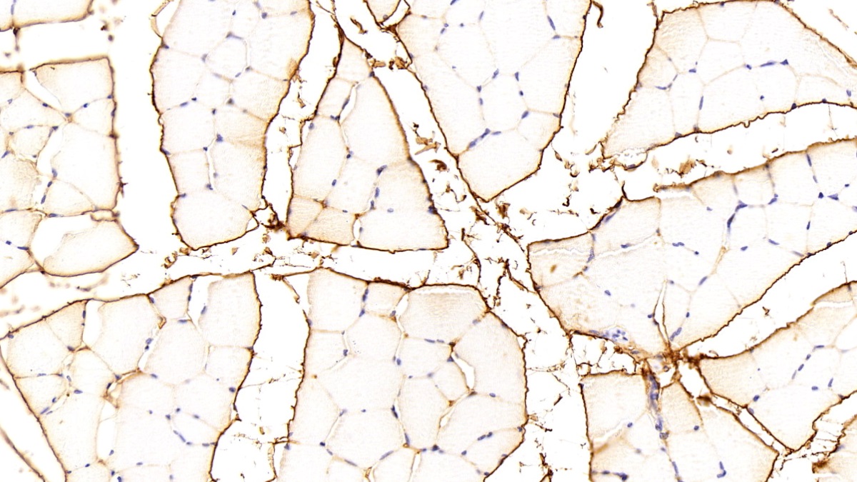 Polyclonal Antibody to Procollagen III N-Terminal Propeptide (PIIINP)