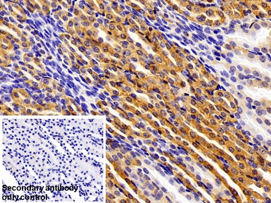 Polyclonal Antibody to Phospholipase A2 Activating Protein (PLAP)