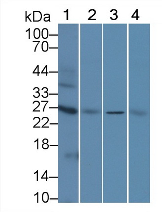 Polyclonal Antibody to Aquaporin 1 (AQP1)