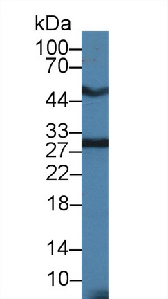 Polyclonal Antibody to Heme Oxygenase 1 (HO1)