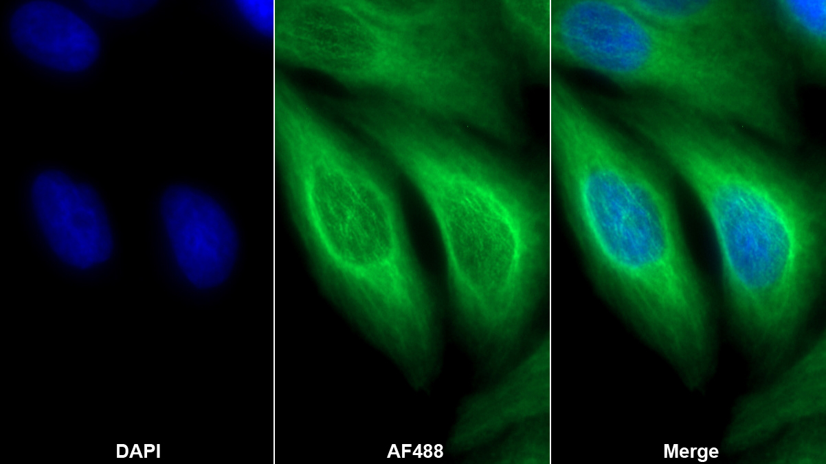 Polyclonal Antibody to Heme Oxygenase 1 (HO1)