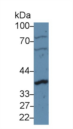 Polyclonal Antibody to Cyclin D1 (CCND1)