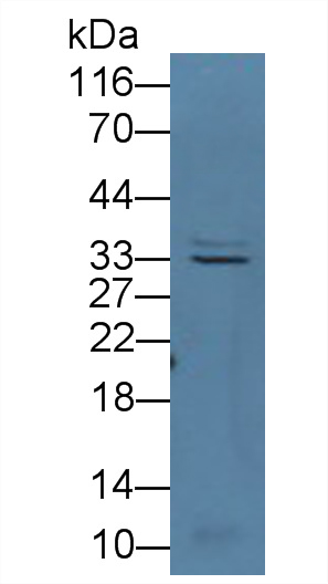 Polyclonal Antibody to Cyclin D3 (CCND3)