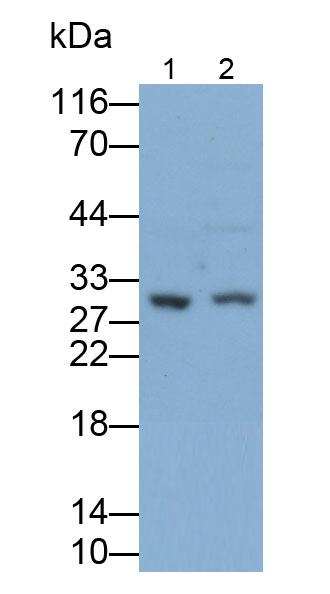 Polyclonal Antibody to Cyclin D3 (CCND3)