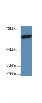 Polyclonal Antibody to Pyruvate kinase isozymes M2 (PKM2)