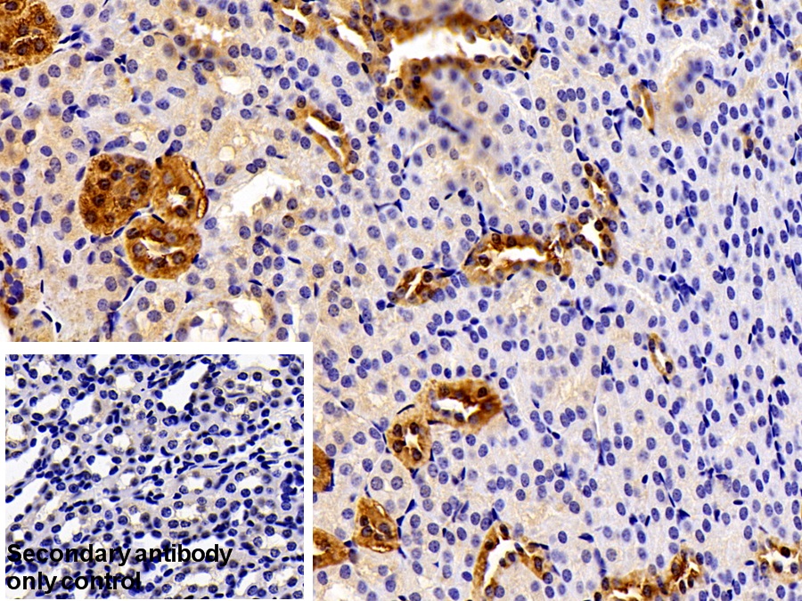 Polyclonal Antibody to Pyruvate kinase isozymes M2 (PKM2)