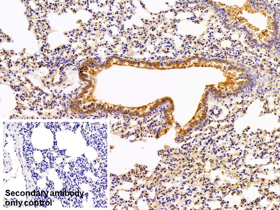 Polyclonal Antibody to Pyruvate kinase isozymes M2 (PKM2)