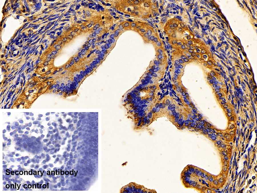 Polyclonal Antibody to Pyruvate kinase isozymes M2 (PKM2)