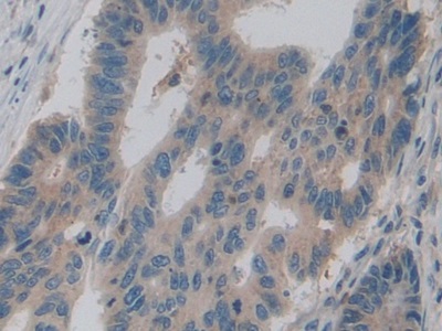 Polyclonal Antibody to Pyruvate kinase isozymes M2 (PKM2)