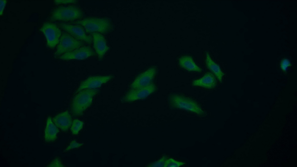 Polyclonal Antibody to Pyruvate kinase isozymes M2 (PKM2)