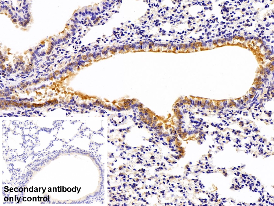 Polyclonal Antibody to Pyruvate kinase isozymes M2 (PKM2)