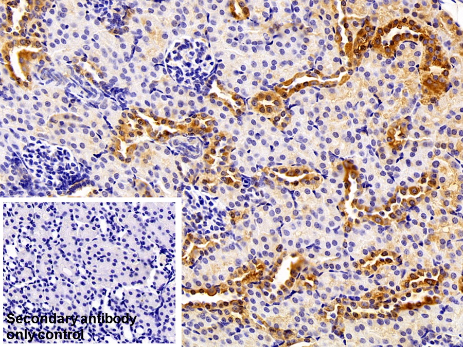 Polyclonal Antibody to Pyruvate kinase isozymes M2 (PKM2)