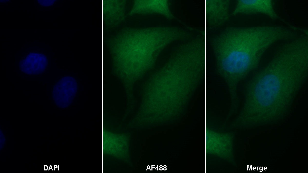 Polyclonal Antibody to Pyruvate kinase isozymes M2 (PKM2)