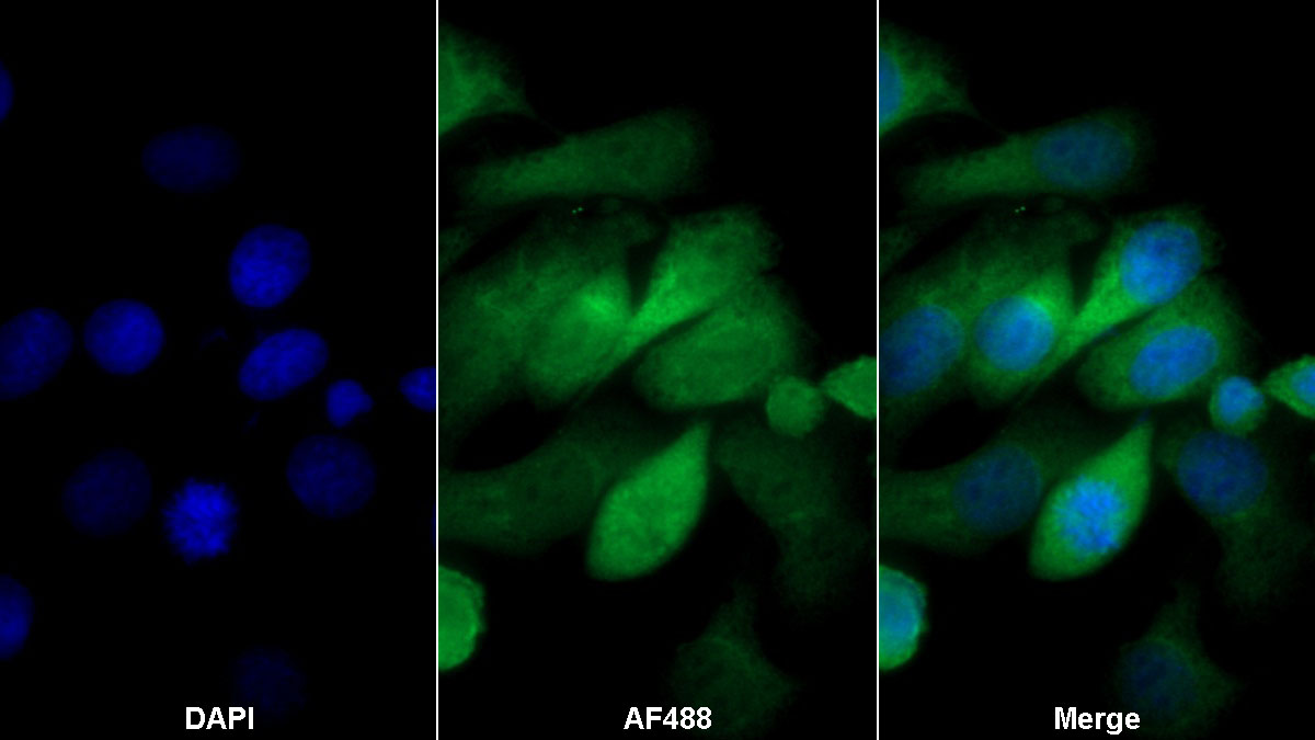 Polyclonal Antibody to Pyruvate kinase isozymes M2 (PKM2)