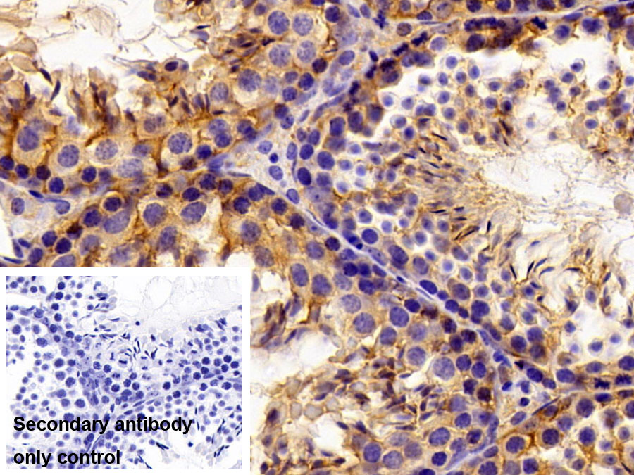 Polyclonal Antibody to Pyruvate kinase isozymes M2 (PKM2)