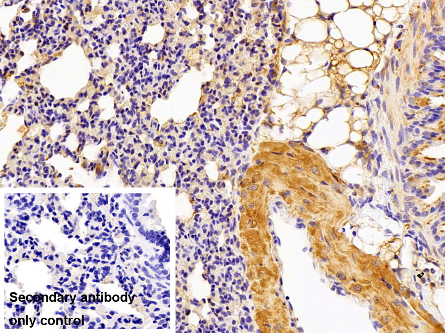 Polyclonal Antibody to Pyruvate kinase isozymes M2 (PKM2)